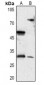 Anti-DIO3 Antibody