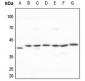 Anti-Galactose Kinase Antibody