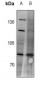 Anti-IGF1 Receptor Antibody