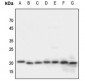 Anti-NDUFA8 Antibody