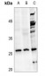 Anti-NDUFV2 Antibody