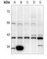 Anti-Pepsinogen C Antibody