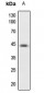 Anti-PKA C alpha/beta/gamma Antibody