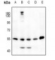 Anti-JNK1/2/3 (pT183) Antibody