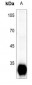 Anti-Trypsin 3 Antibody