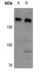 Anti-ARID4B Antibody