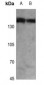 Anti-PHLPP Antibody