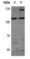 Anti-STK31 Antibody