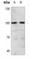 Anti-ADAMTS1 Antibody