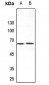 Anti-ARMCX2 Antibody