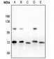 Anti-ARNT2 Antibody