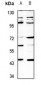 Anti-SH3GLB2 Antibody