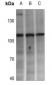 Anti-Adenylate Cyclase 4 Antibody