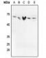 Anti-SMAD2/3 (pT8) Antibody