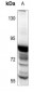 Anti-STAT5 Antibody