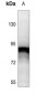 Anti-STAT5 (pY694/699) Antibody