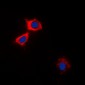 Anti-CaMK2 alpha/delta Antibody