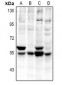 Anti-CaMK2 alpha/delta Antibody