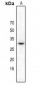 Anti-MMP26 Antibody