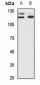 Anti-PPP1R13B Antibody