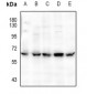 Anti-CaMK2 alpha/delta (pT286) Antibody