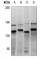 Anti-CDCA2 Antibody