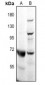 Anti-CD218b Antibody