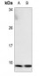 Anti-NDUFA3 Antibody