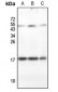 Anti-RPLP2 Antibody