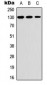 Anti-Thrombospondin 2 Antibody