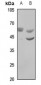 Anti-WASF3 Antibody