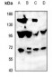 Anti-ATG16L2 Antibody