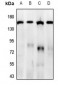 Anti-GPR158 Antibody