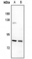 Anti-UTP14A Antibody