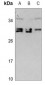 Anti-CDCA4 Antibody