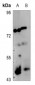 Anti-c-Jun (pS73/100) Antibody