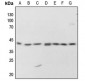 Anti-PKA C alpha/beta/gamma (pT198) Antibody