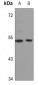 Anti-GPR172B Antibody