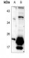 Anti-TUSC5 Antibody