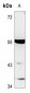 Anti-TTC23 Antibody