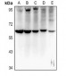 Anti-MT-ND5 Antibody