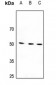 Anti-Beta-1 Adrenergic Receptor Antibody