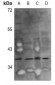 Anti-GGH Antibody