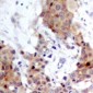 Anti-FOXO1/3 Antibody