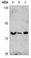 Anti-FOXO1/3 Antibody