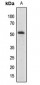 Anti-SMAD2/3 (AcK19) Antibody