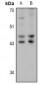 Anti-HSD17B2 Antibody