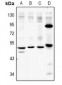 Anti-P2X2 Antibody