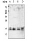 Anti-p16 ARC Antibody