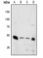 Anti-Synaptotagmin (pT202/199) Antibody